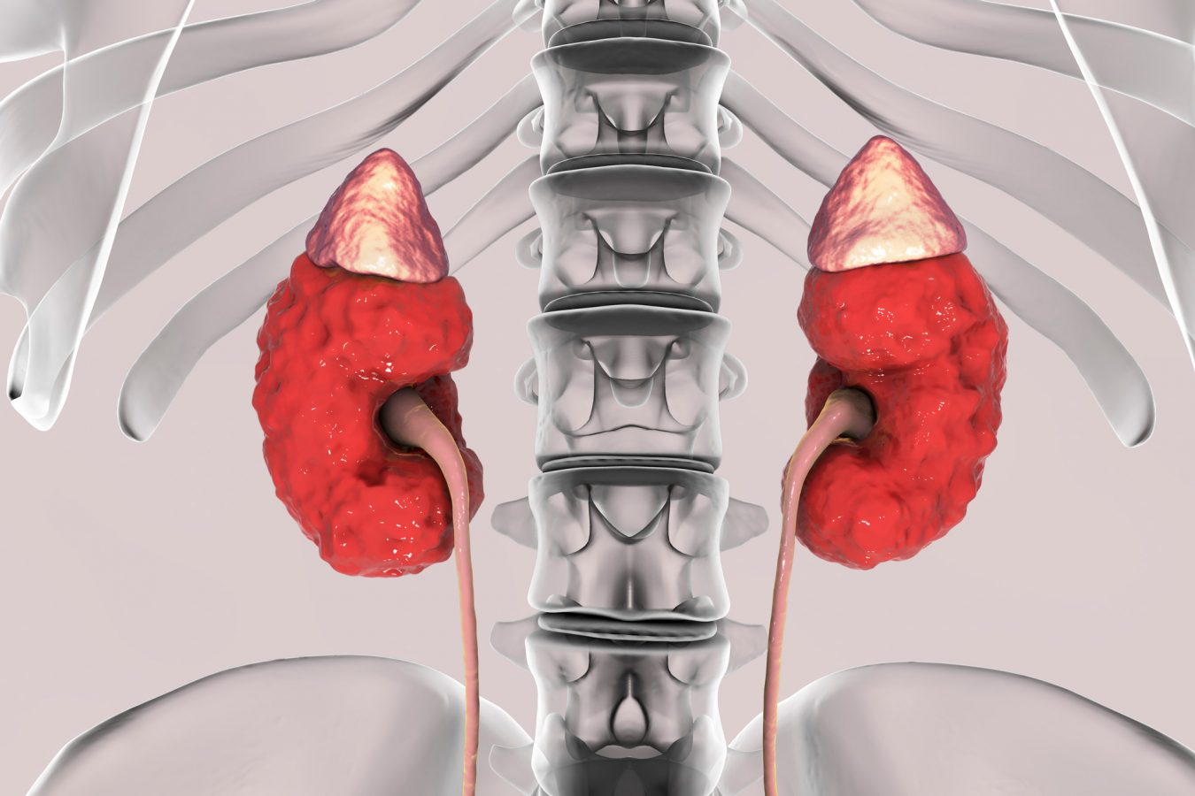 Side Effects and Other Systems Affected When You Have Kidney Disease - CHOP